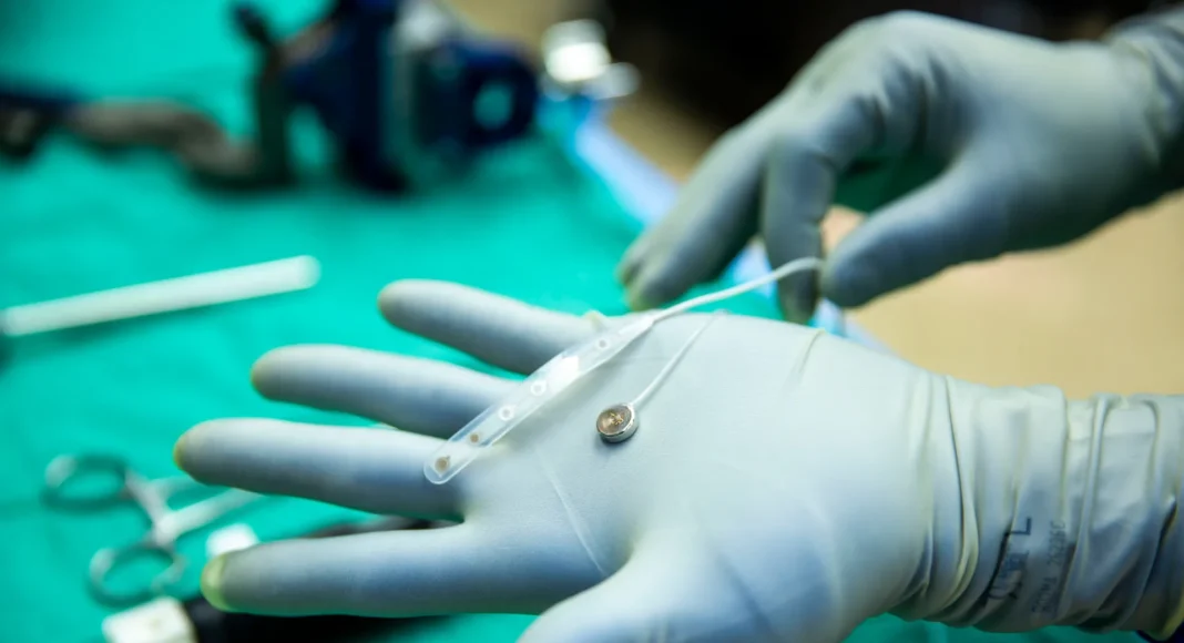 Implante cerebral rival de Neuralink es probado en humano