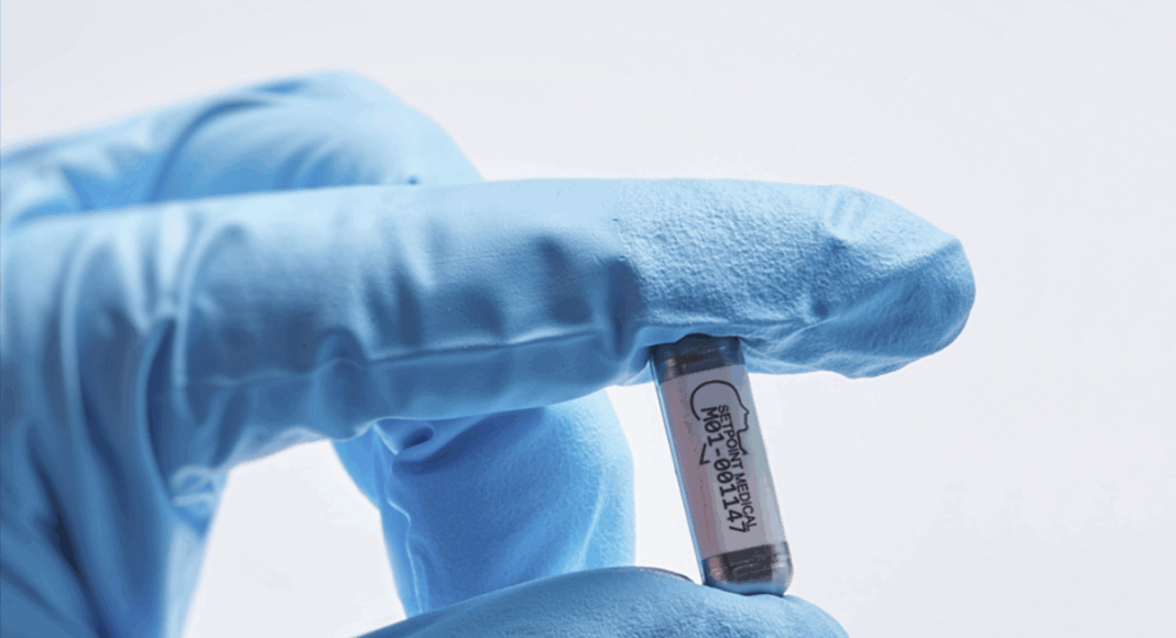 FDA aprueba chip que controla la artritis reumatoide con impulsos eléctricos
