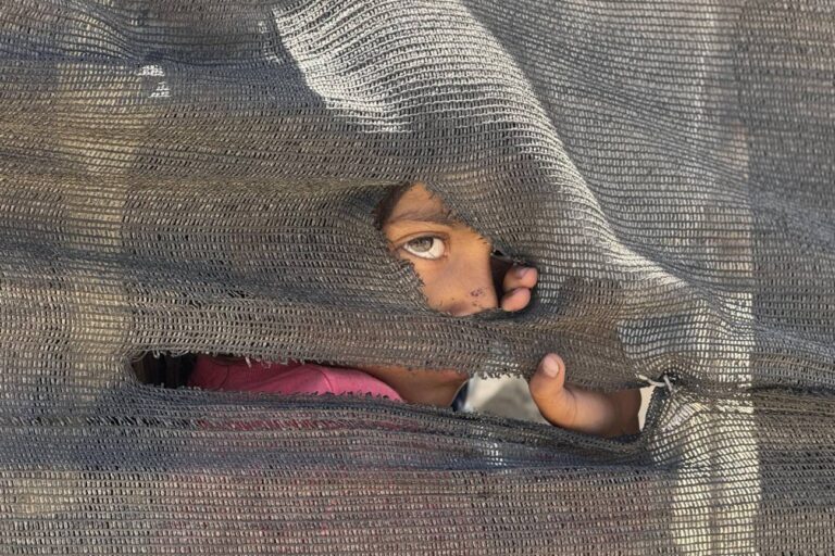 Desnutrición infantil en Gaza sigue en niveles críticos pese al alto el fuego