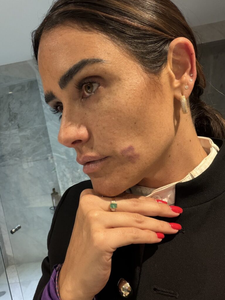 Alessandra Rojo denuncia agresión en operativo en Zona Rosa 1 Alessandra Rojo denuncia agresión en operativo en Zona Rosa