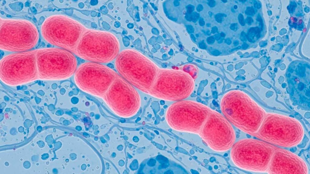 Europa alerta por aumento de gonorrea resistente a antibióticos 1 Europa alerta por aumento de gonorrea resistente a antibióticos